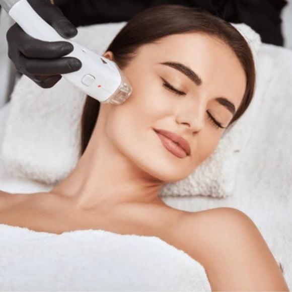 Sides or Cheeks Laser Hair Removal