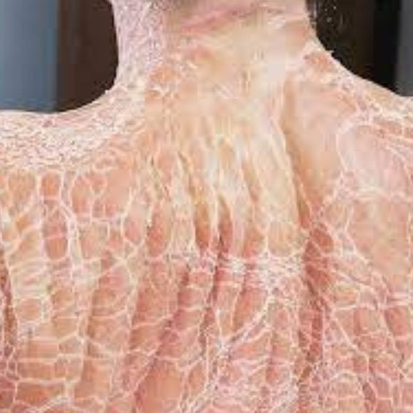 DMK Body Enzyme Therapy - Back