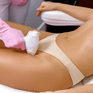 G-String Laser Hair Removal