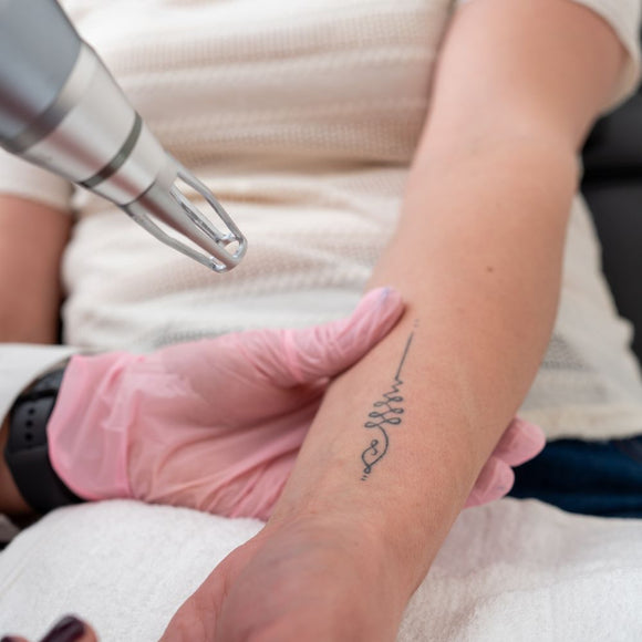 Laser Tattoo Removal 7cm x 7cm